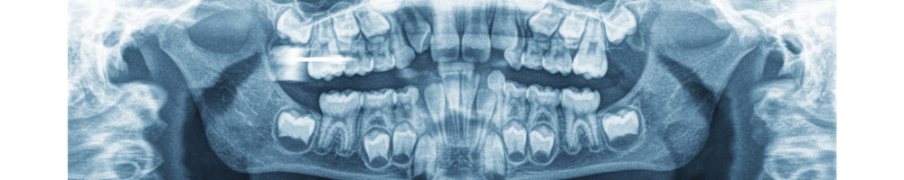 rentgen jamy ustnej dziecka