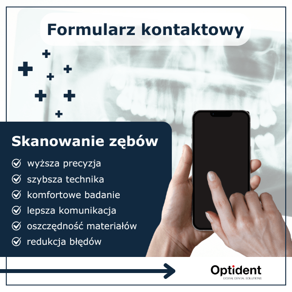 Formularz kontaktowy Zasada dzialania skanera zebow 3D