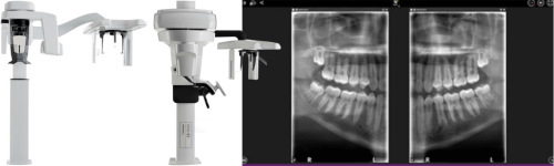 2 tomografy i zdjęcie CBCT