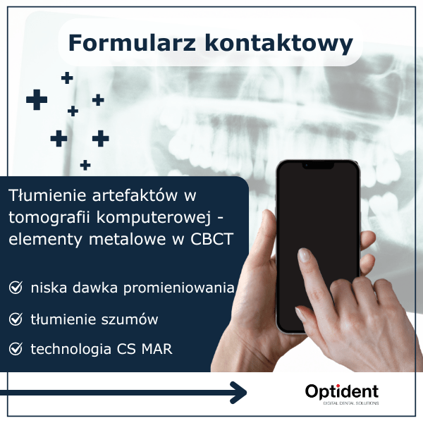 Formularz kontaktowy Tłumienie artefaktów w tomografii komputerowej - elementy metalowe w CBCT