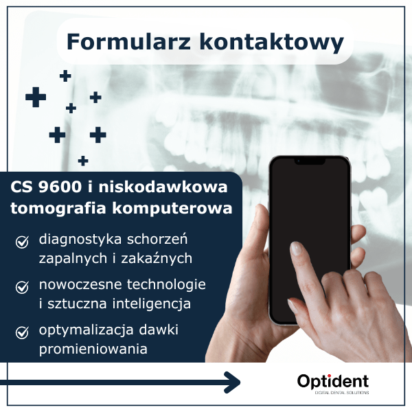 Formularz kontaktowy CS 9600 i niskodawkowa tomografia komputerowa