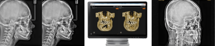 cephalometric points carestream