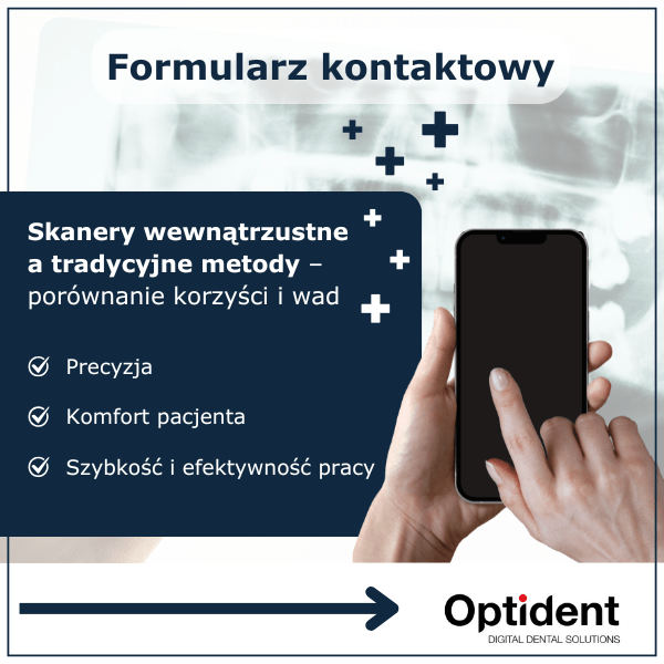 Skanery wewnątrzustne a tradycyjne metody – porównanie korzyści i wad